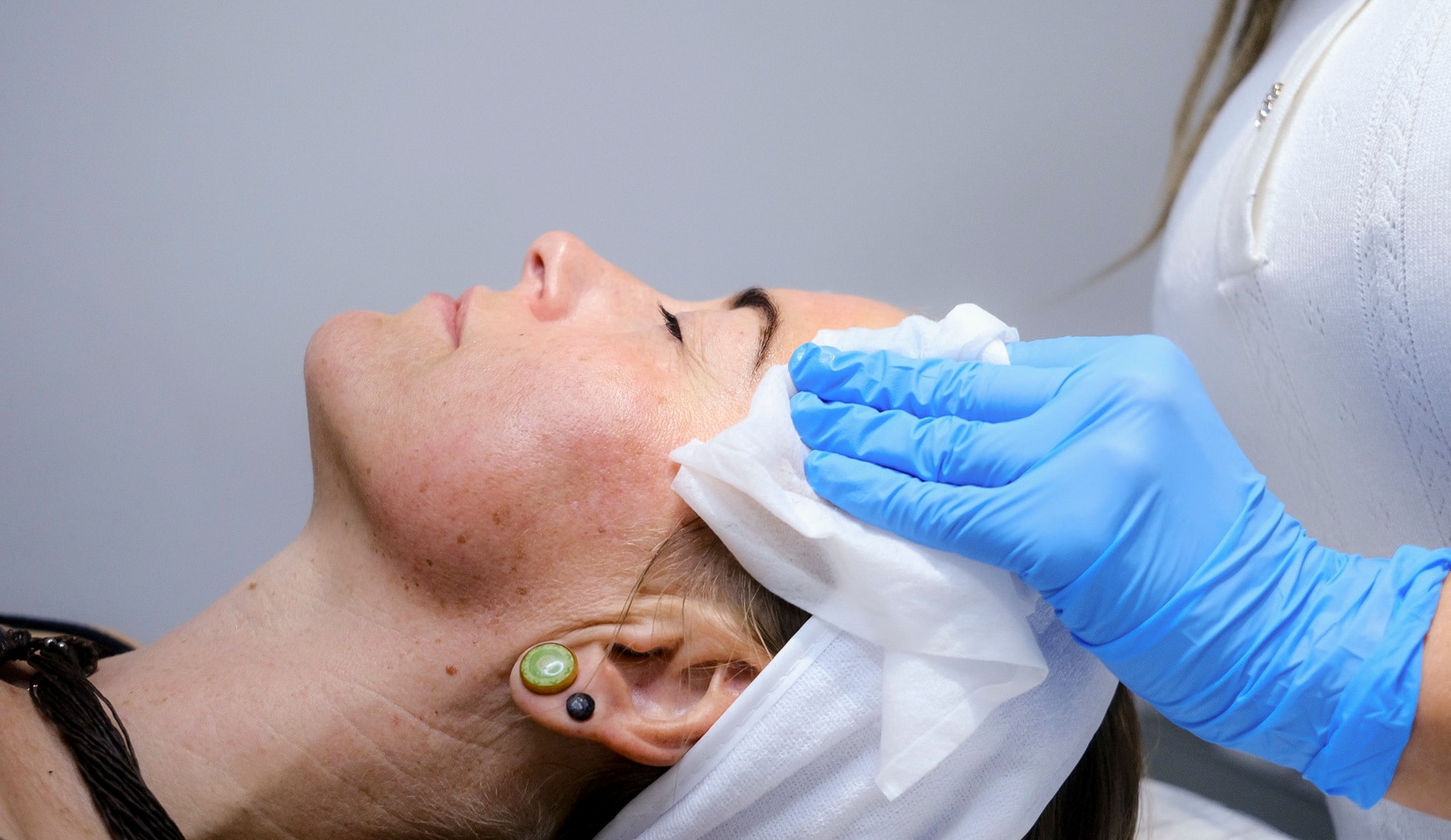 Anti-age Ansigtsbehandling