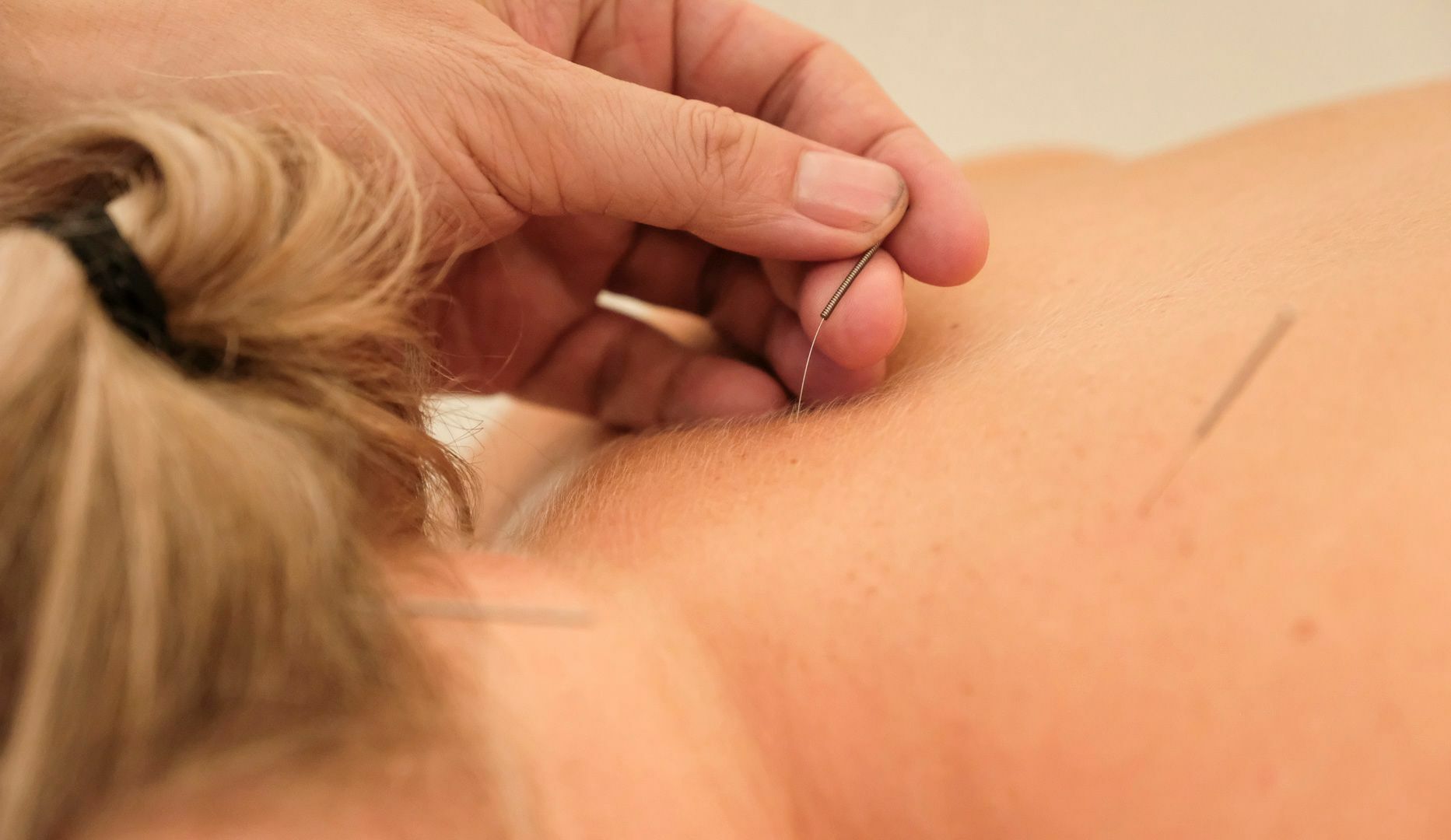 Massage, zoneterapi el. akupunktur