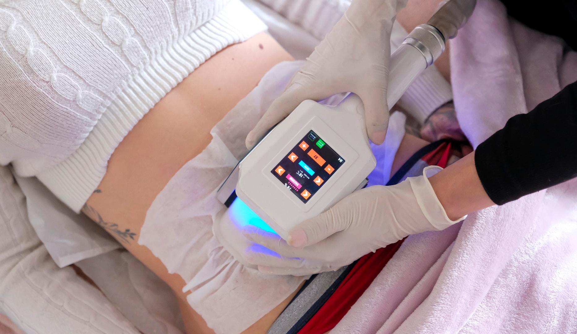 EMsculpting & Fedtfrysning - Frederiksberg