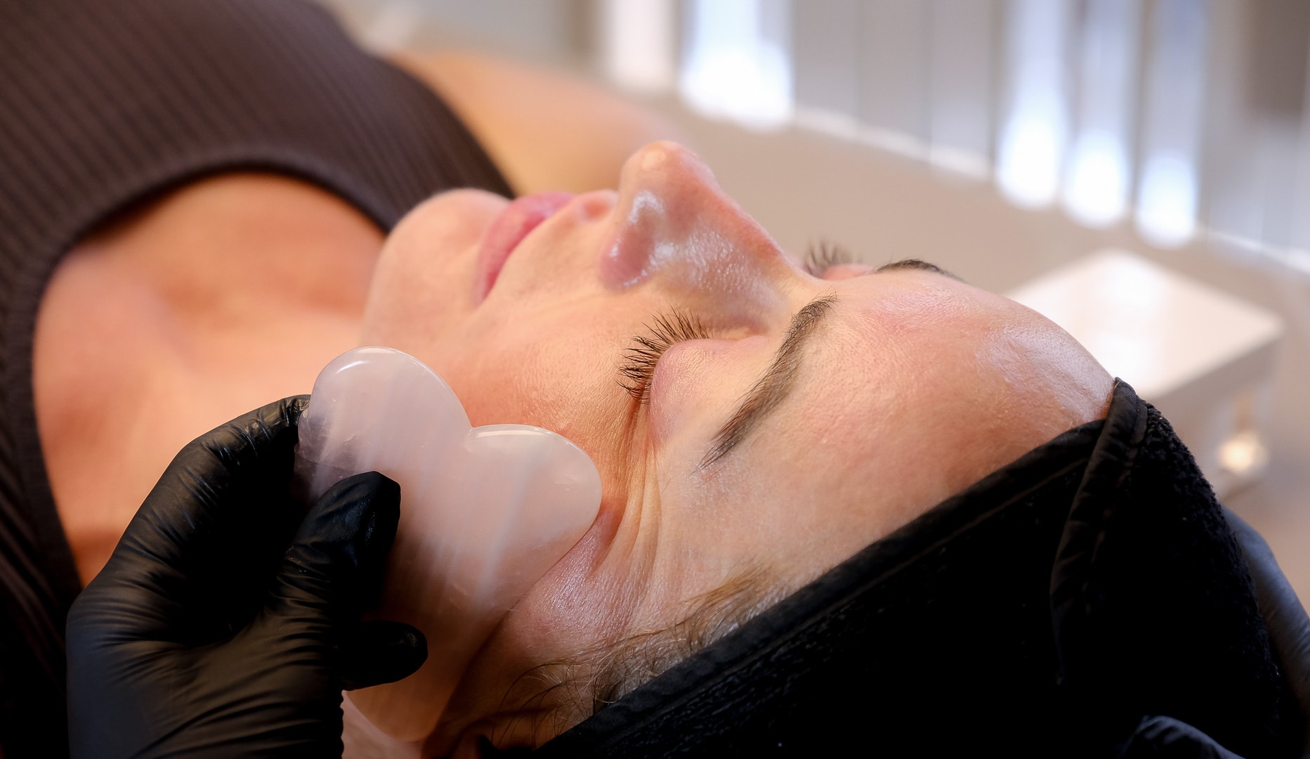 NYHED: Microneedling/Skin Recovery-behandling
