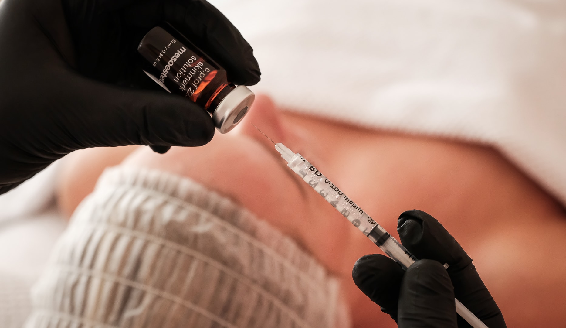 Microneedling - Spar over 50 %