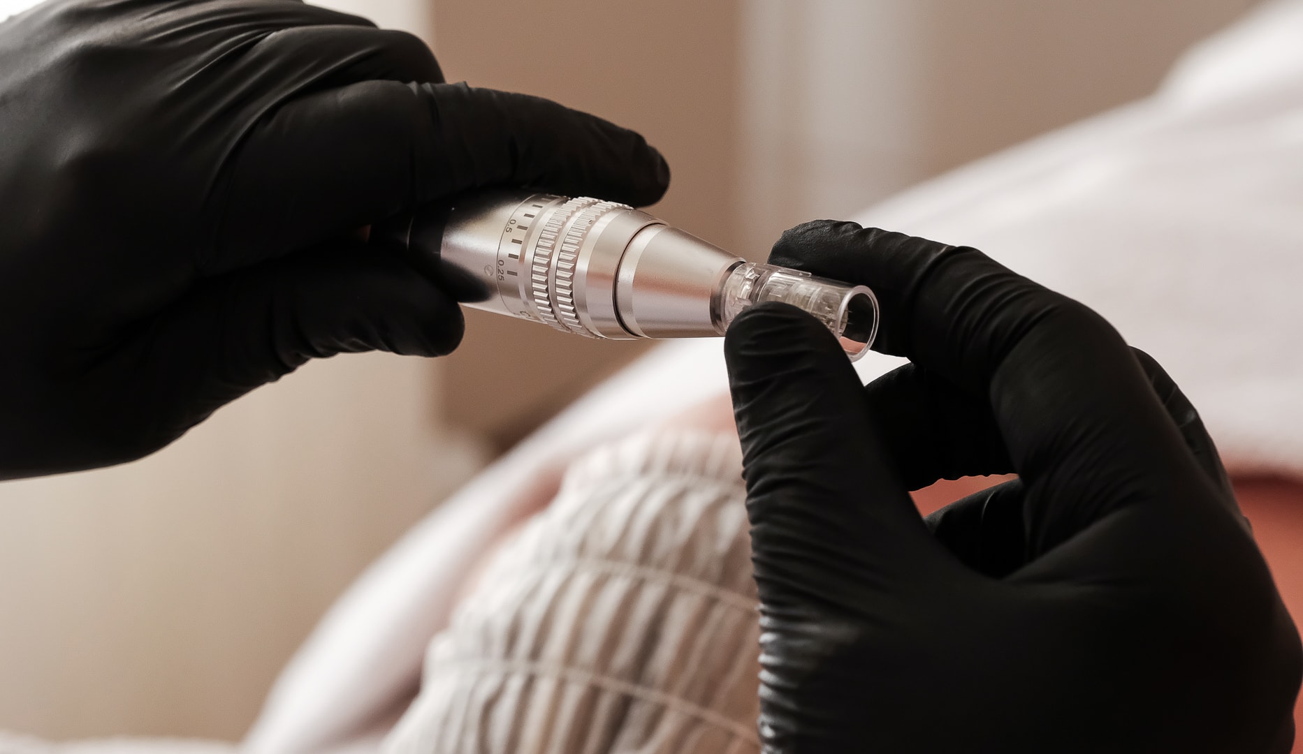 Microneedling - Spar over 50 %