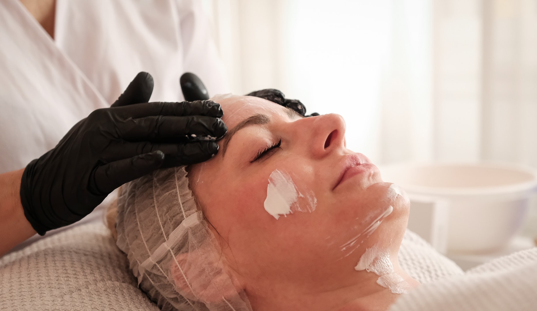 Microneedling - Spar over 50 %