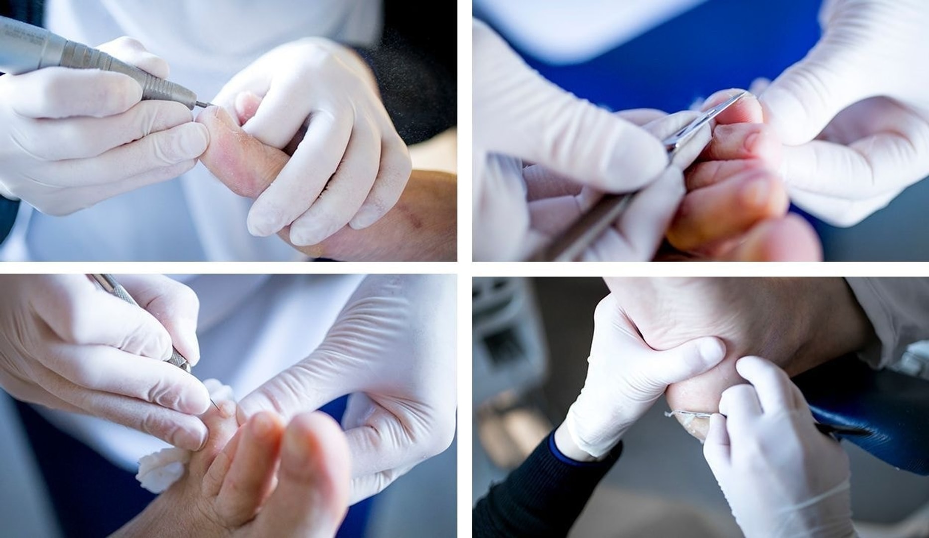 60 min. fodbehandling