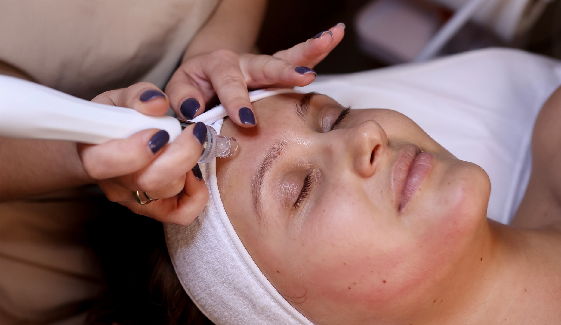 Ansigtsbehandlinger - Spar over 50 %