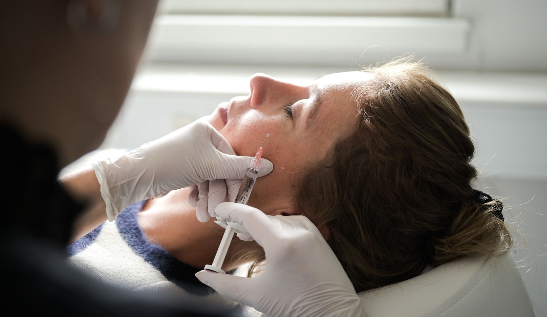 Profhilo-behandling - Lyngby