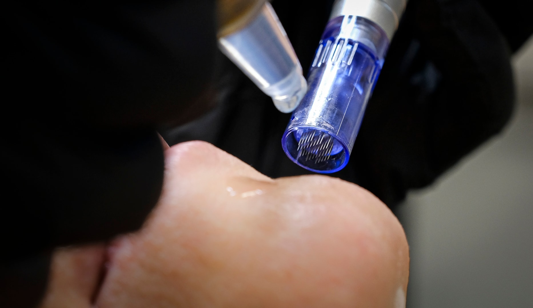 ½ Pris på Ansigtsbehandling