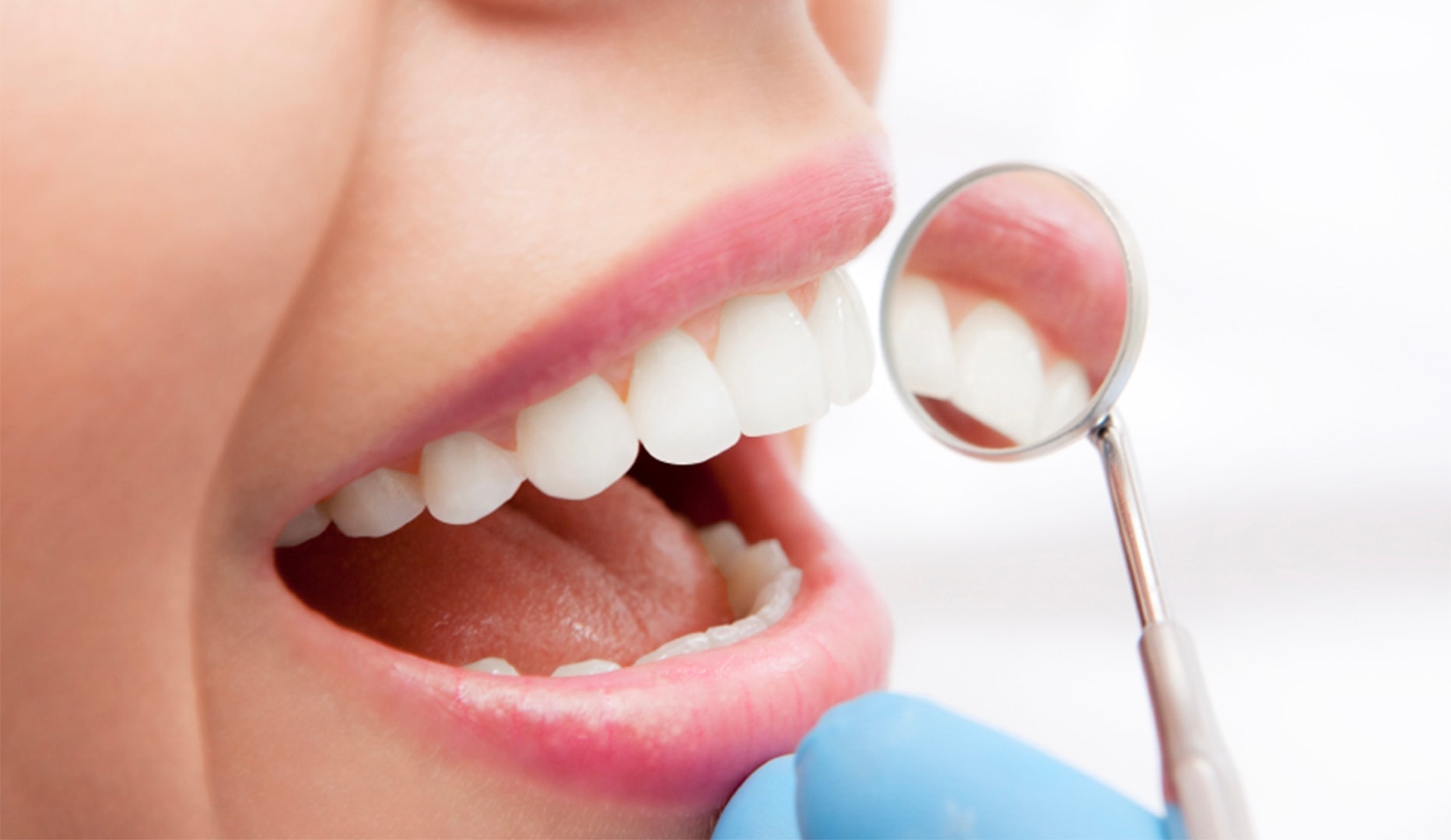 Professionelt Tandeftersyn