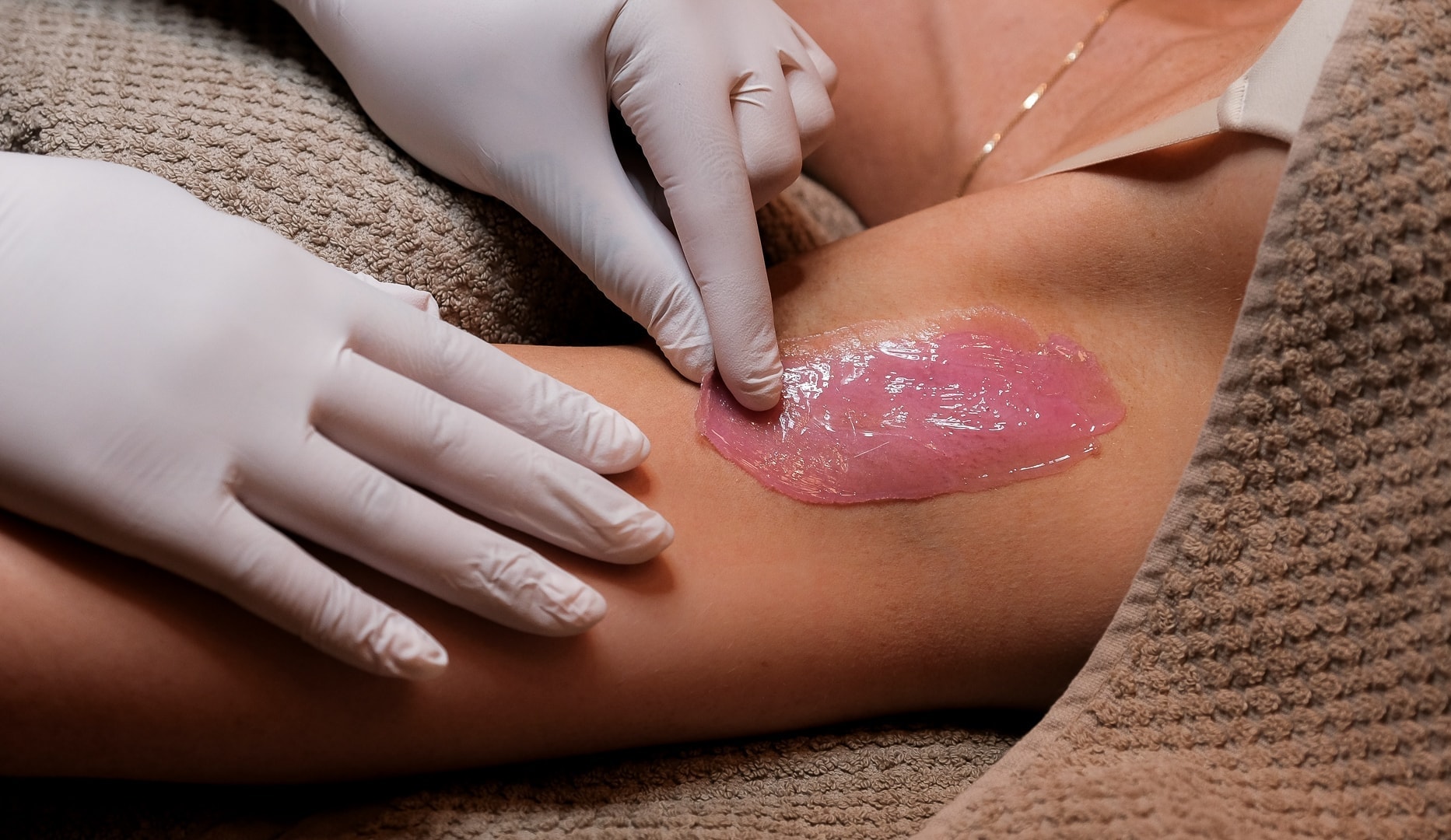 Skånsom Hårfjerning med Sugaring