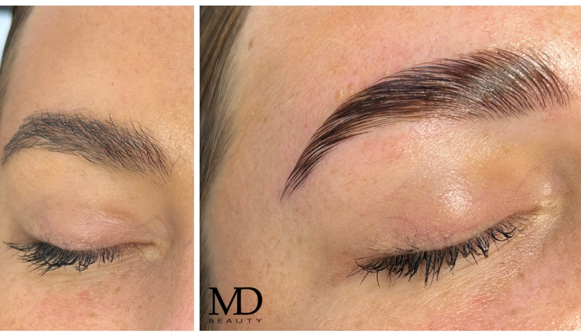 Lash/Brow Lift - MD Beauty