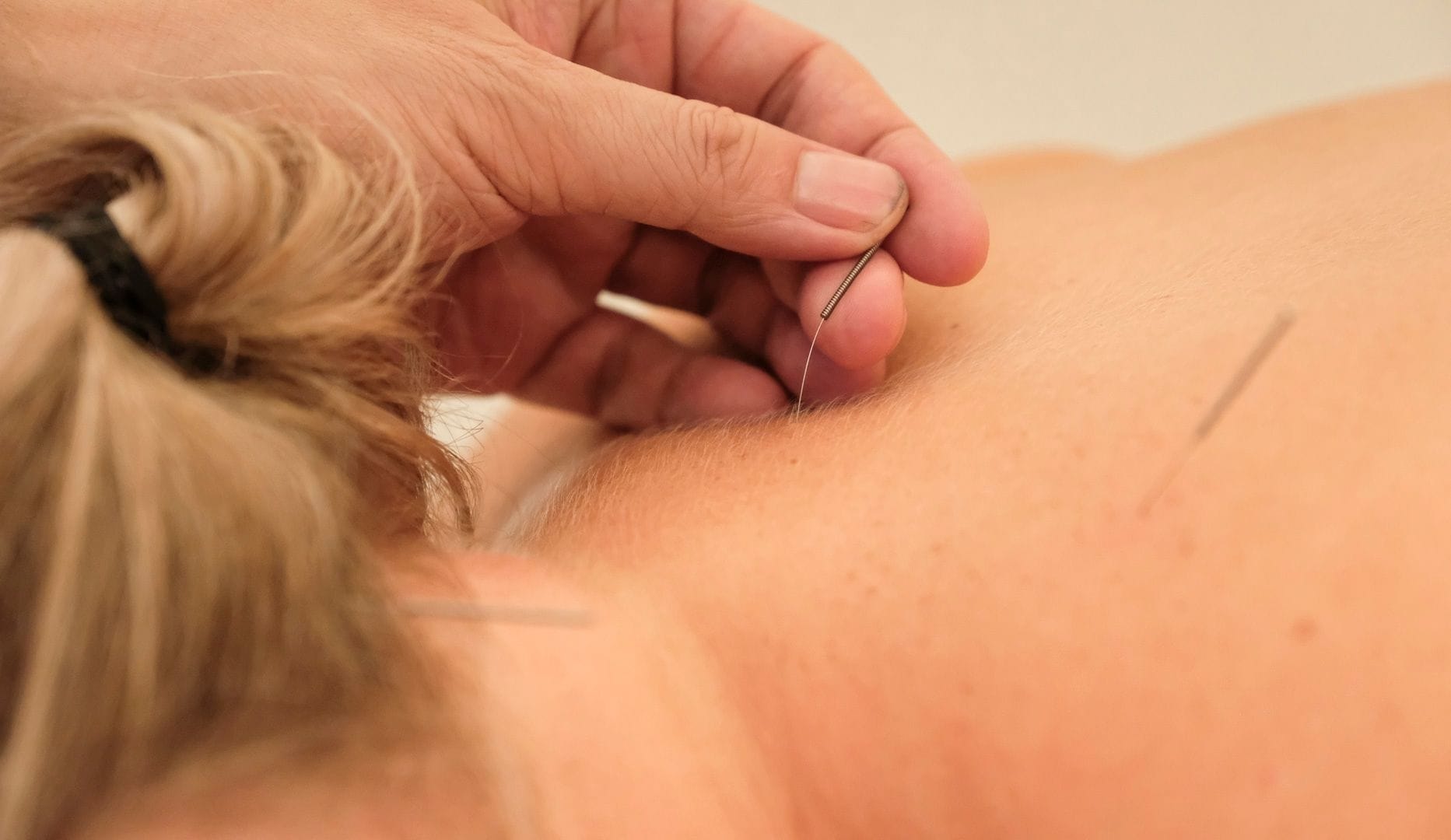 Massage & akupunktur