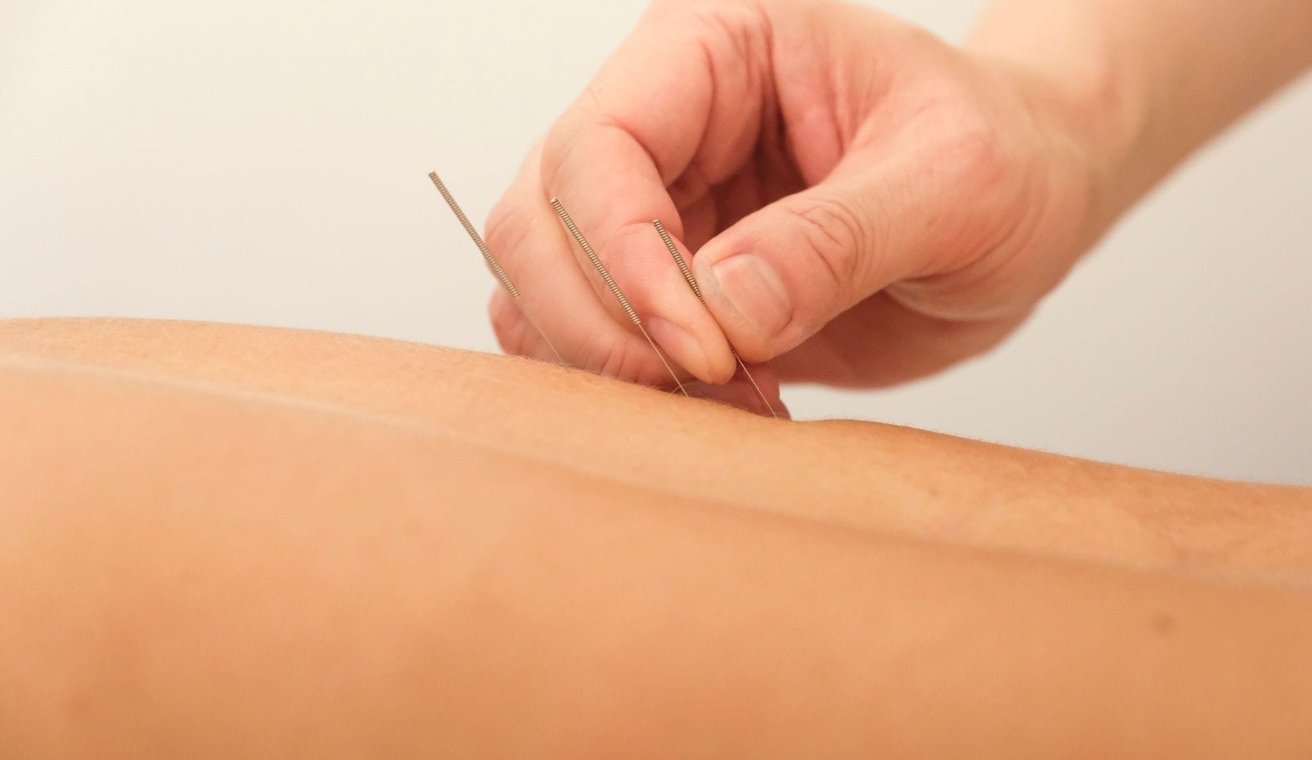 Massage & akupunktur