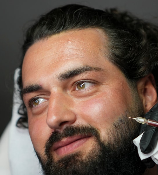 PRF mod hårtab | 1-3 behandlinger!