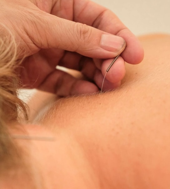 Oplagt julegave: Massage el. akupunktur | Spar op til 65 %