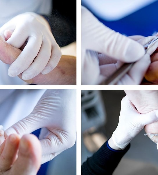 Spar 40 % | 60 min. fodbehandling