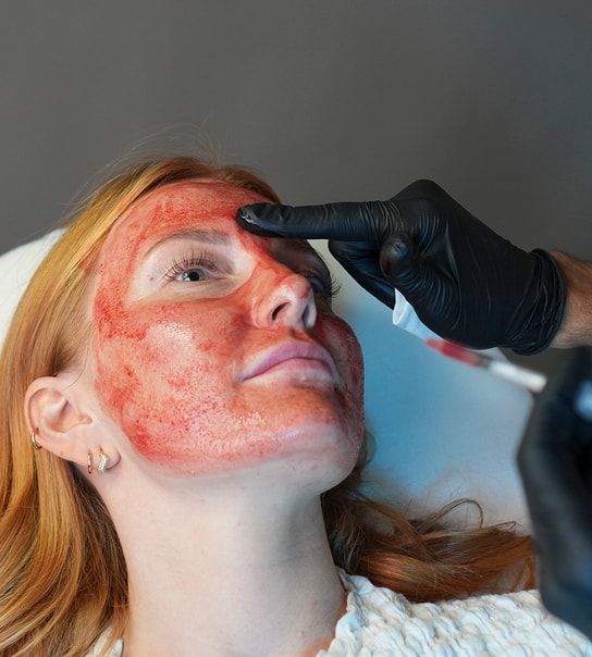 PRF mod Hårtab & PRF Ansigtsbehandling