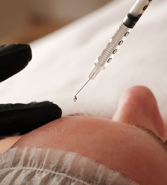 Microneedling - Spar over 50 %