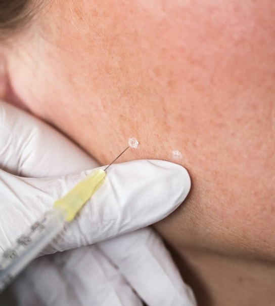 Autoriseret botox