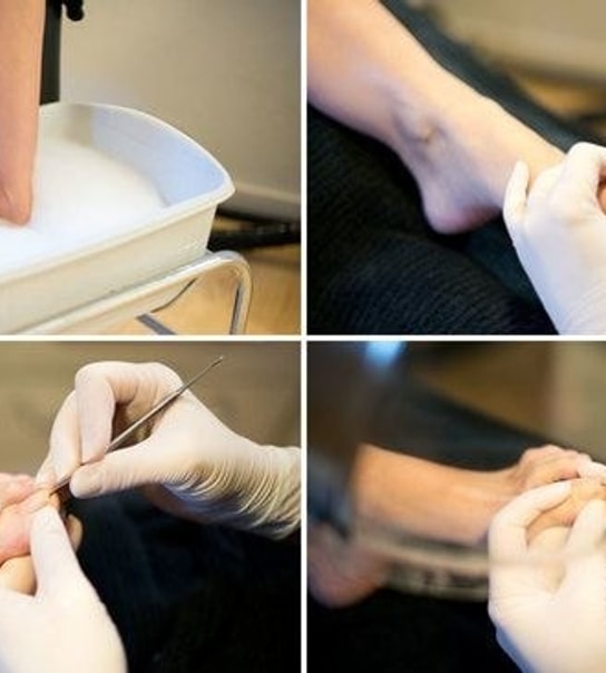 Luksuriøs fodbehandling