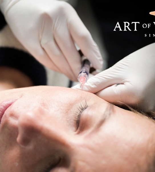 Profhilo-behandling - Lyngby