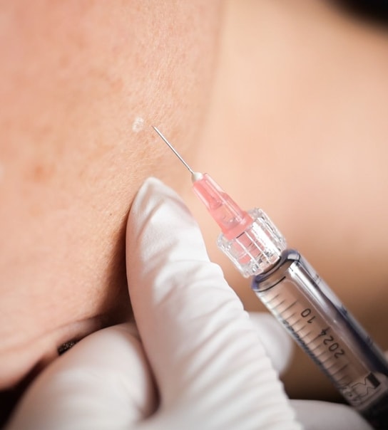 Profhilo-behandling - Lyngby