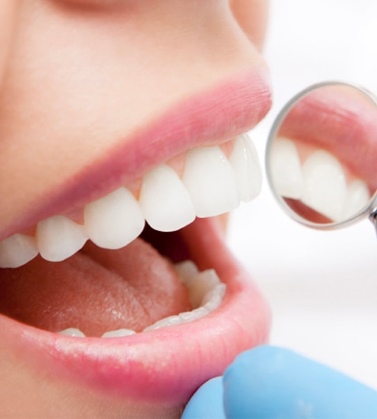 Professionelt Tandeftersyn