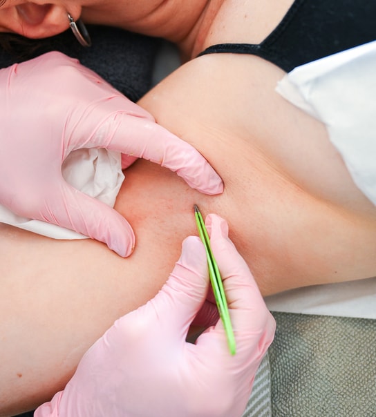 Voksbehandling - Kosmetolog Valby