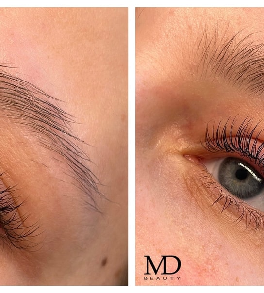 Lash/Brow Lift - MD Beauty
