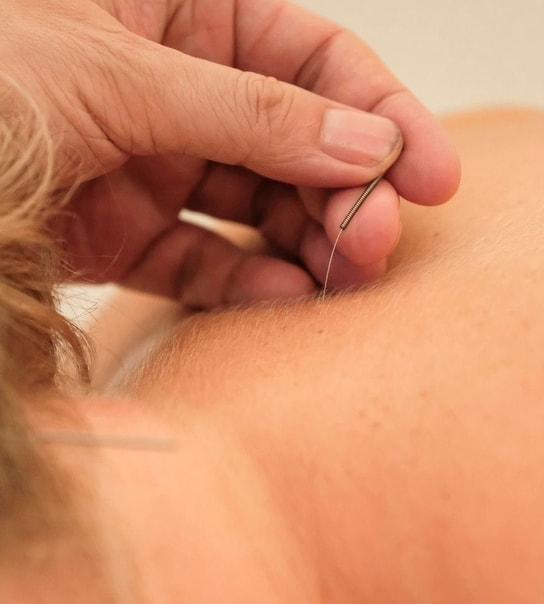Massage & akupunktur